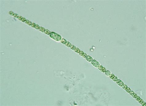 Prokaryote Cyanobacteria Anabaena