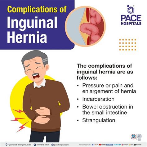 Inguinal Hernia Signs And Symptoms Types Causes Risk Factors