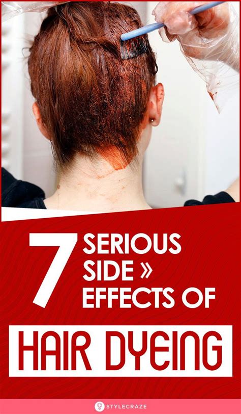 7 side effects of hair dyeing dyed hair hair dandruff bleached hair