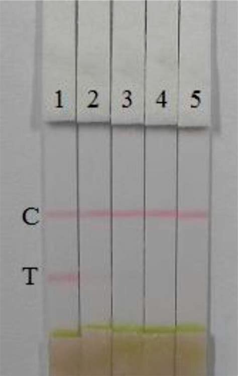 Results Of Ald Detection With Colloidal Gold Immunochromatographic