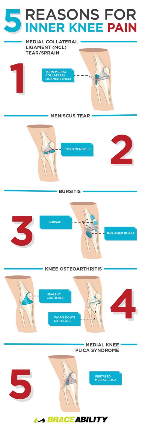 Knee Pain Location Chart Knee Pain