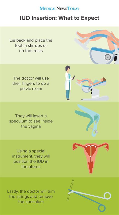 Iud Insertion A Guide And What To Expect