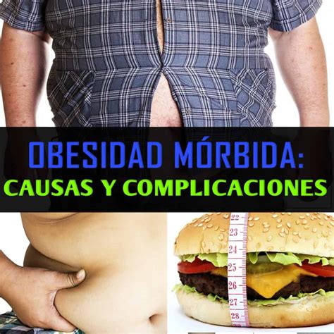 Obesidad Morbida La Guía De Las Vitaminas