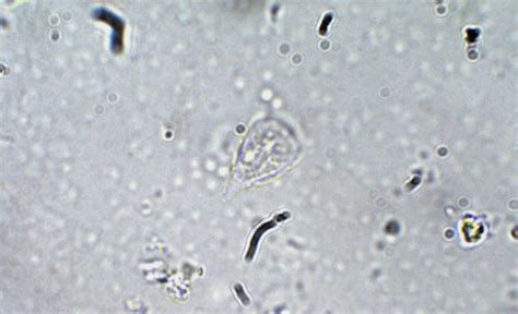 Giardia Lamblia Trophozoite Parasitology