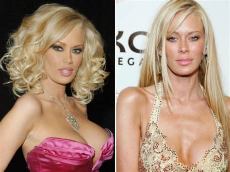 Jenna Jameson Botox And Plastic Surgery Before And After Photos