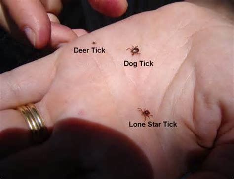 Ticks Tick Bites Hubpages