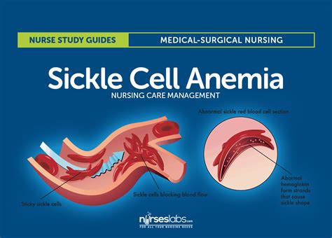 6 Sickle Cell Anemia Nursing Care Plans Care Plans Nursing Care Plan