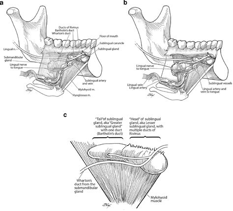 Sublingual Gland Operative Techniques In Otolaryngology Head And Neck