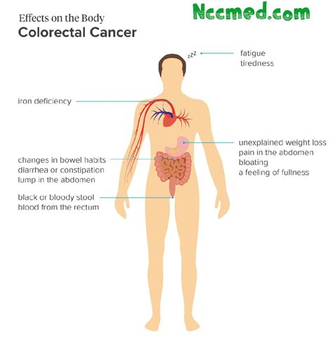Causes Of Colorectal Cancer Symptoms Treatment And Risk Factors