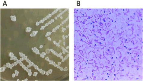 Bacillus Velezensis A2 Fermentation Exerts A Protective Effect On Renal