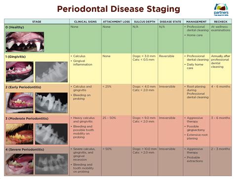 Dentistry Periodontal Disease Staging