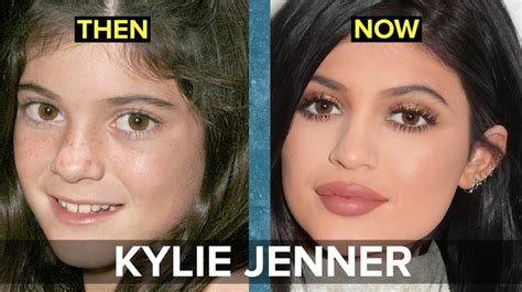 See her before and after photos through the years. The Kardashians: Then Vs. Now