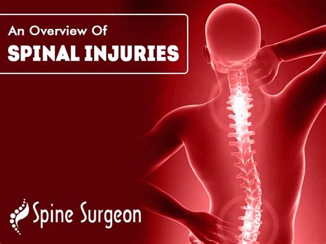 An Overview Of Spinal Injuries Spine Surgeon