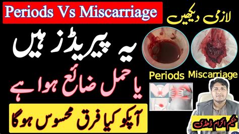 Period Or Miscarriage Early Periods Or Miscarriage Period Blood