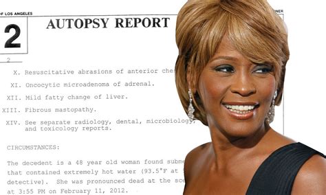 Whitney Houston Autopsy Report Found Face Down In Bath As Drugs Lay