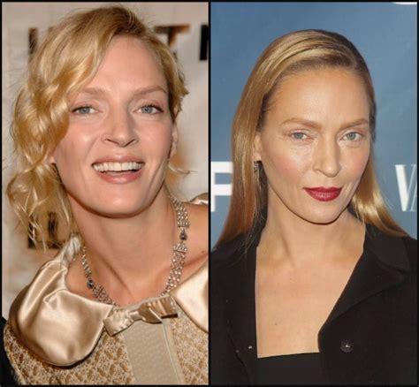 Uma Thurman Plastic Surgery Damned If She Does Damned If She Doesnt