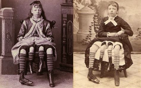 Josephene myrtle corbin'in kim olduğunu öğrendim ve dikkat çekici olan 4 ayaklı olmasıdır, 4 ayaklı demiş olmam sakın sizi yanıltmasın. Josephine Myrtle Corbin: conheça a história da mulher com quatro pernas | Pukka´s Journal