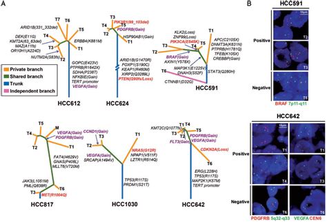 Genomic And Transcriptional Heterogeneity Of Multifocal Hepatocellular