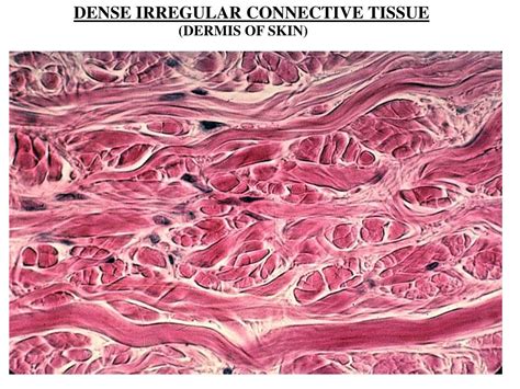 Is Skin Is A Connective Tissue