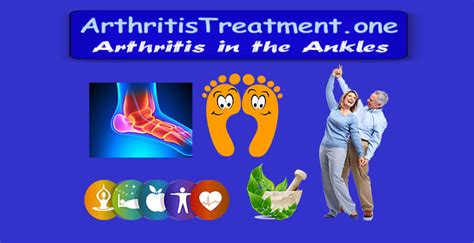 Arthritis In The Ankles Arthritis Treatment
