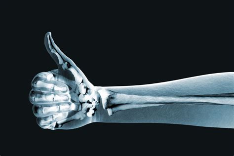 Raleigh Hand Surgery — Joseph J Schreiber Md