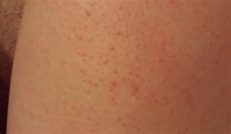 12 things your skin is trying to tell you Dry flaky skin
