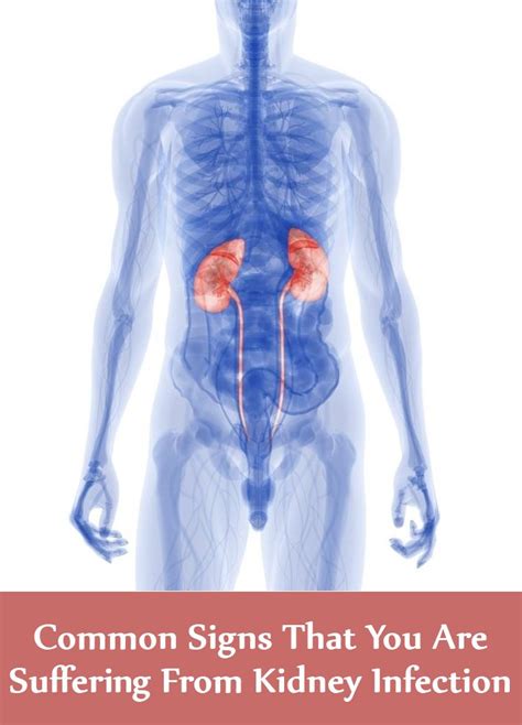 6 Common Signs That You Are Suffering From Kidney Infection Find Home