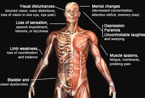 These include eye problems, pins and needles, fatigue and pain. Multiple Sclerosis (MS) Symptoms and Treatment