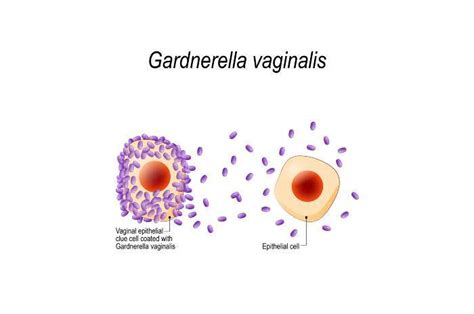 Infezione Da Gardnerella Vaginalis Sintomi E Trattamento