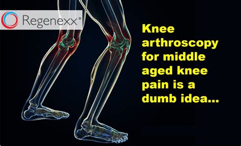 Some of it may be simple to explain. Knee Surgery for a Meniscus Tear? Not if You're Middle Aged.
