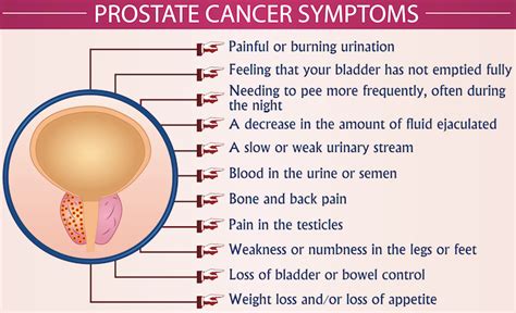 Prostate Cancer Symptoms Infographic Vector Illustration Health Healthcare And September