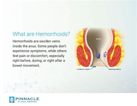 hemorrhoids signs symptoms and treatment options