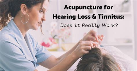 Acupuncture For Hearing Loss And Tinnitus Does It Really Work Hearing