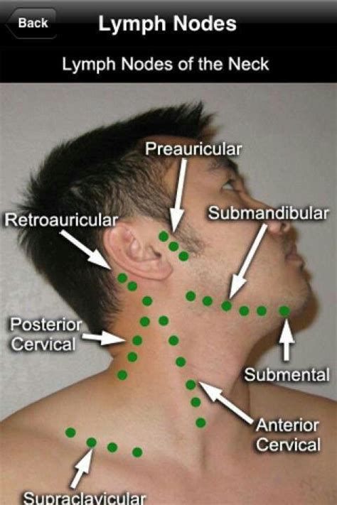 Medicalvocabulary Visualvocabulary Lymph Node Location And Names For