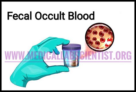 Faecal Occult Blood Tests Fobts Significance Methods