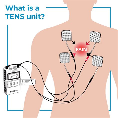 The Ultimate Guide To Tens Units What Tens Units Are How They Work And Why Theyre