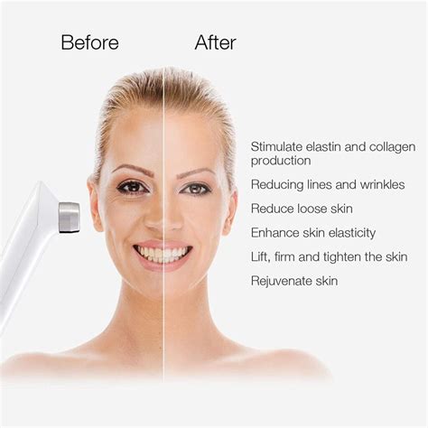 Be The First To Review Mlay Rf Radio Frequency Facial And Body Skin
