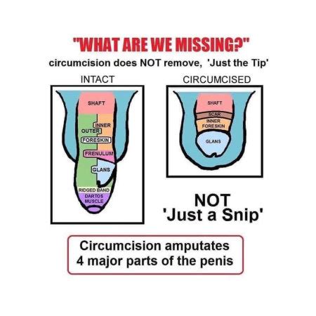 Circumcision Explained