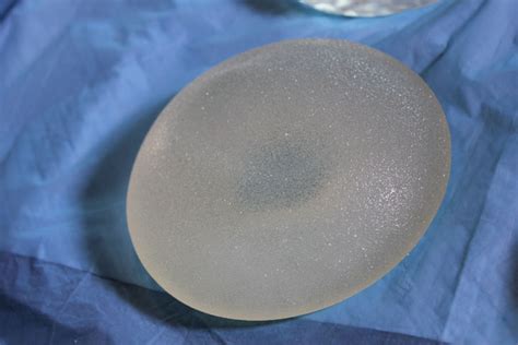 How Safe Are Breast Implants Women Warn Of Risks Share Their Symptoms