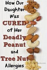 Pictures of Cashew Nut Allergy Treatment