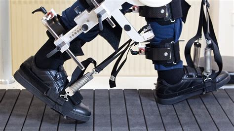 Robotic Assisted Gait Training Gets Thumbs Up From Poststroke Patients