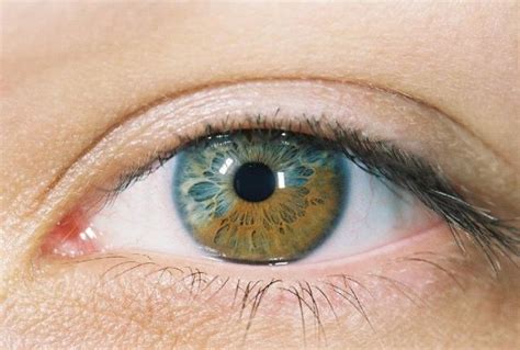 Laser Procedure Turns Brown Eyes Blue