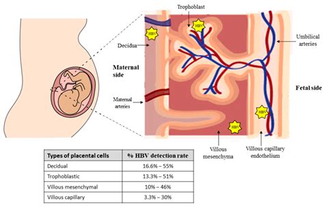 Microorganisms Free Full Text Vertical Transmission Of Hepatitis B