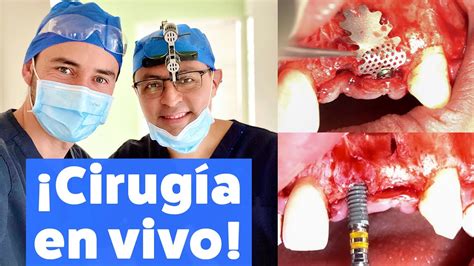 Simple Science: How to Make a Volcano with Kids