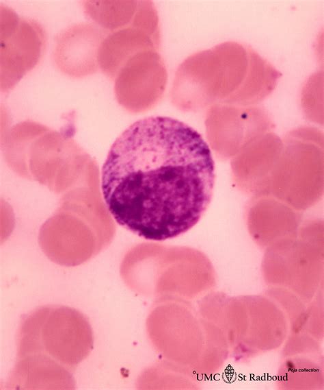Neutrophilic Myelocyte In Bone Marrow Smear Human Poja Collection