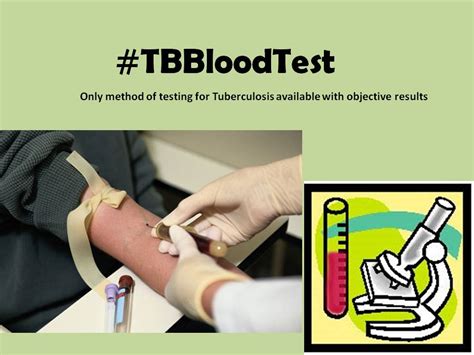 A New Way To Test For Tuberculosis Tbbloodtest My Life Is A Journey