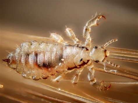 Head Lice How Do They Spread Symptoms Treatment And Prevention