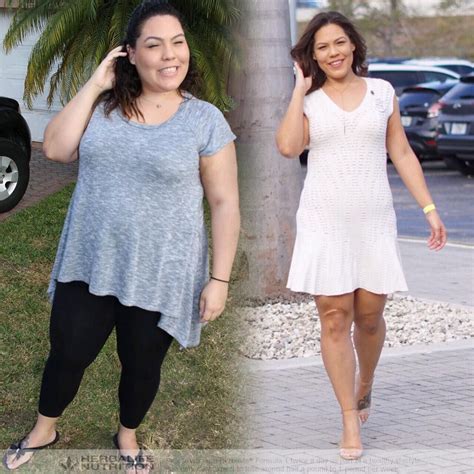 You Will Be Floored After Seeing These Women Whove Lost 100 Pounds