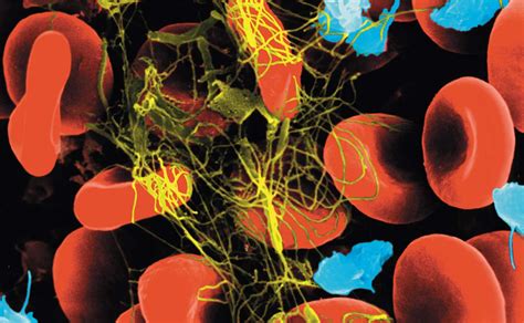 En el proceso de coagulación (hemostasia), las plaquetas. ¡Cuidado, sangre! 10 funciones de las plaquetas