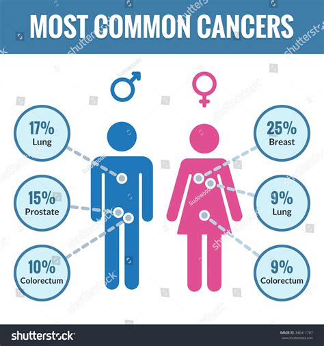 Common Cancer Infographics Top Three Cancer Stock Vector Royalty Free